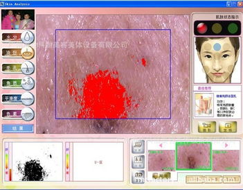 皮测大师 特价直供，智能皮肤分析新标杆